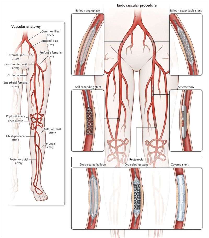 Vascular Anatomy of Humans