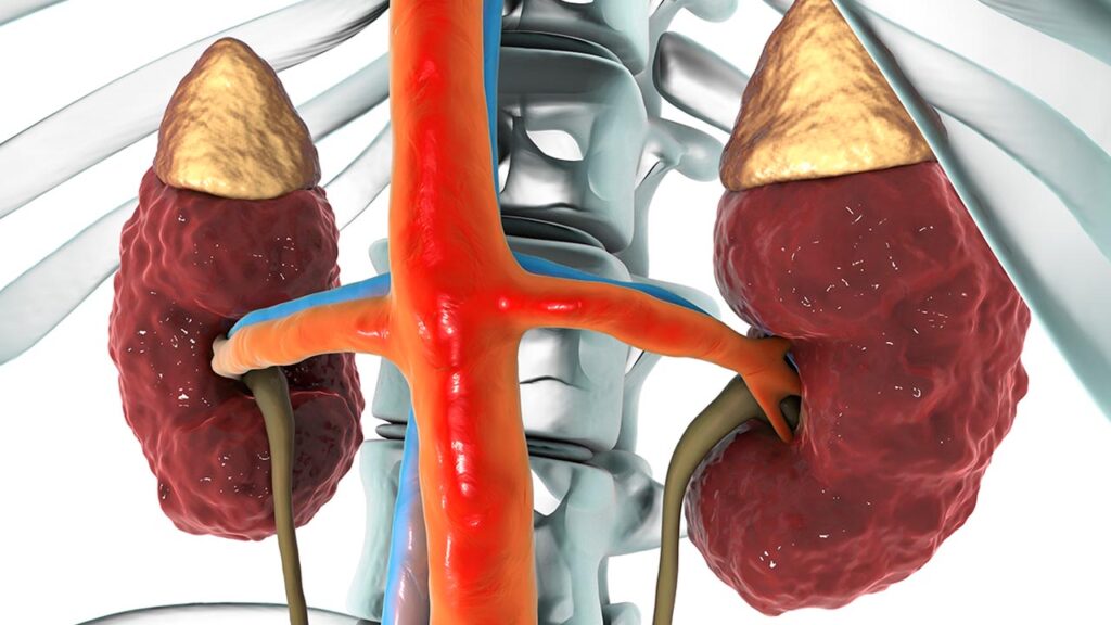 how-does-vascular-disease-affect-kidneys-vascular-health