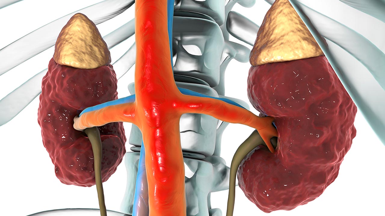 Vascular Diseases That Affect Kidneys