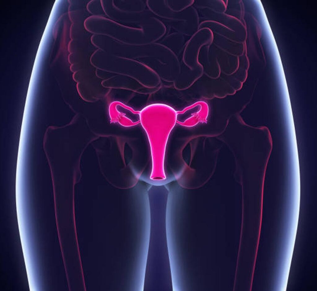 uterine fibroids in women