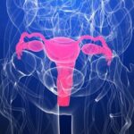 uterine fibroid embolization