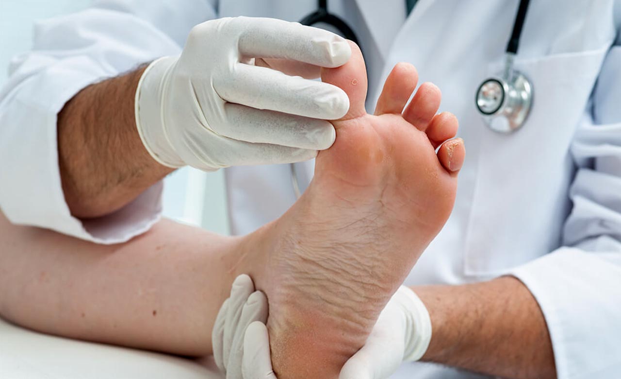 Diabetes and Foot Care
