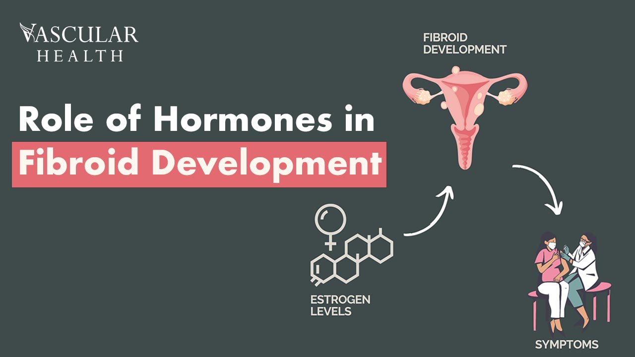 Hormones in Fibroid Development