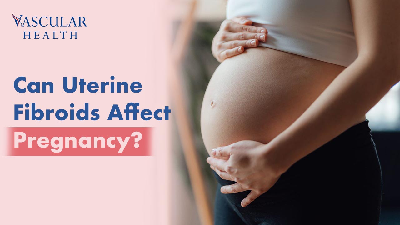 Uterine Fibroids Affect Pregnancy