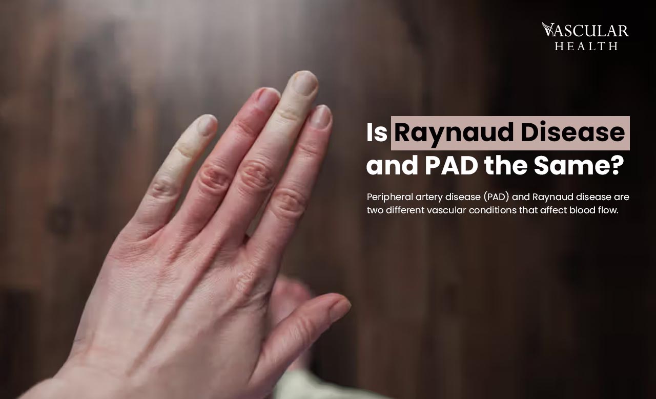 Raynaud disease