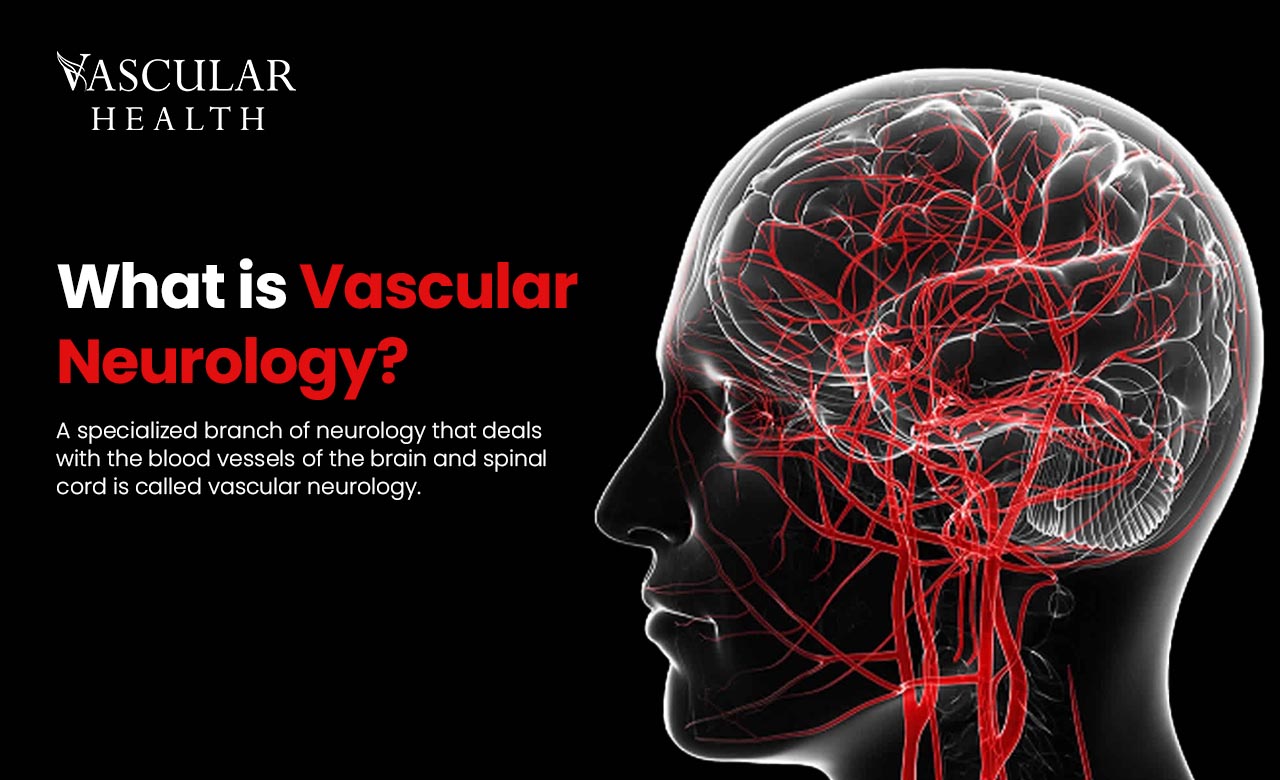 Vascular Neurology