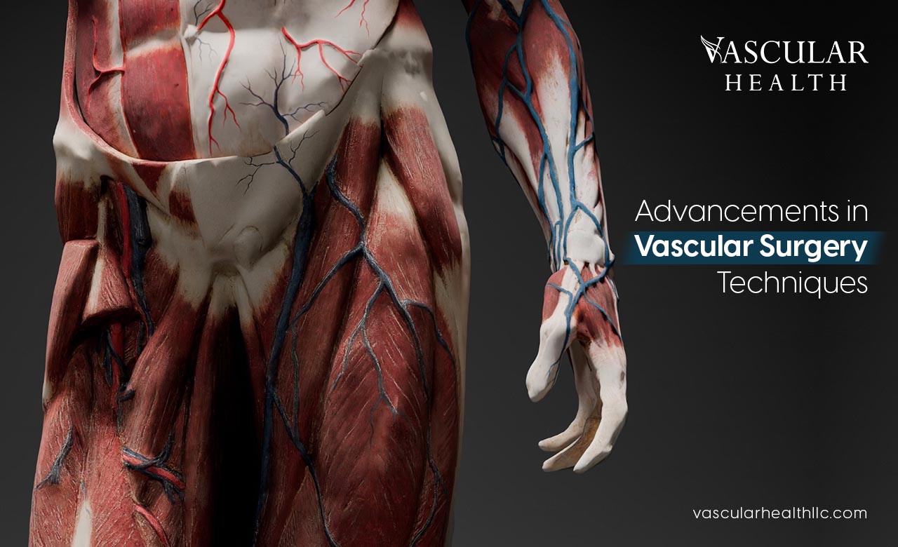 Vascular Surgery