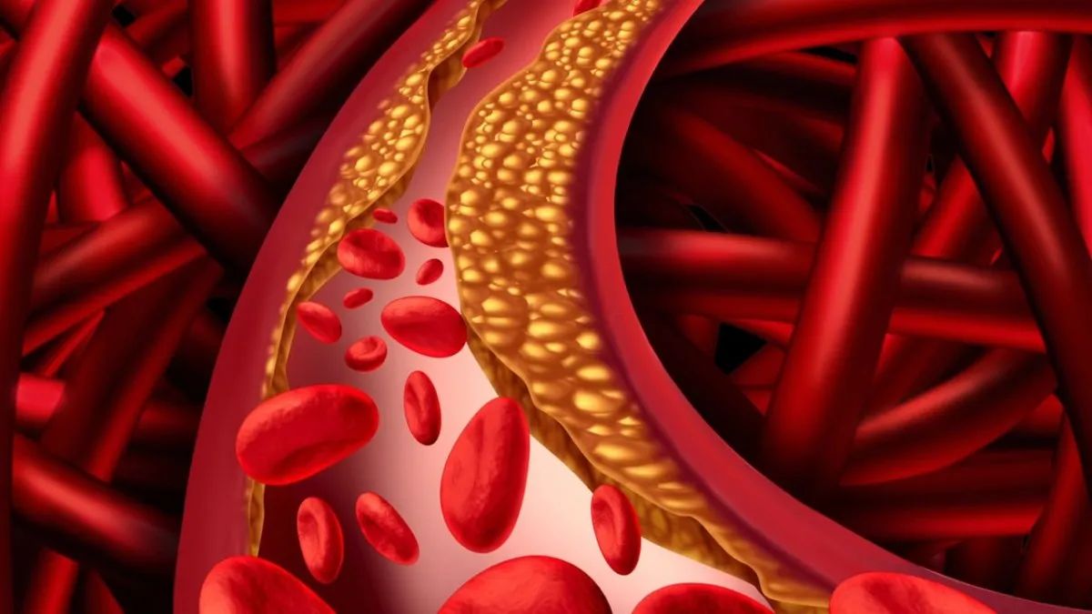 Vascular Calcification and Calcium